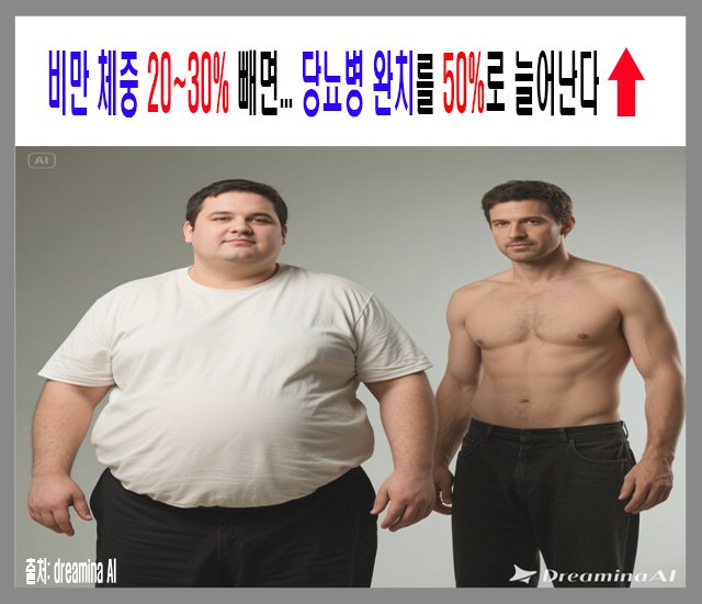 [건강 #13] 비만 체중 20~30 빼면...jpg